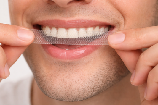 Teeth Whitening Kit – Brighter Smile at Home